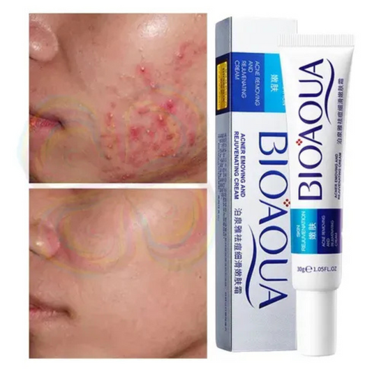 BioAqua Crema Reparadora Antiacné